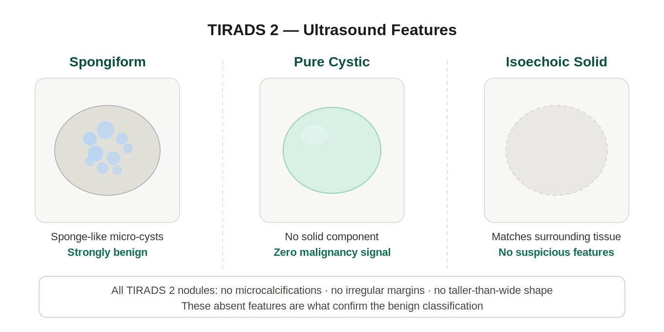 Tirads Examples TIRADS 2: Not Suspicious (Benign) Category in Thyroid Nodule ...